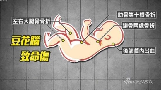 据台媒报道,在台湾的彰化,19岁的年轻爸妈奉子成婚,上个月,这对年轻爸妈又因为情绪不稳重摔3个月大的男婴,导致婴儿脑浆碎裂,经医生检查确定死亡。年轻爸妈辩称没有虐待只是不会带小孩。不过从这位小爸爸的个人社交媒体上发现,夫妻俩宁愿花时间玩游戏,长时间挂在网络上,还常为了谁来照顾小孩吵架,显见根本不是不会养小孩,而是不想养。不过热恋时满心期待的爱情结晶,最后因为养不起不想负责任,活活把孩子虐待致死,还毫无悔意,令人实在觉得太离谱。